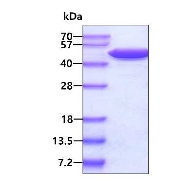 SDS-PAGE: Recombinant Human Enolase 1 Protein [NBP1-30262]
